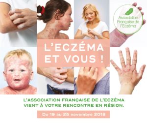 semaine eczéma