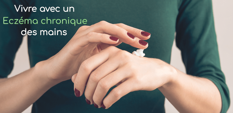 ECZEMA CHRONIQUE DES MAINS