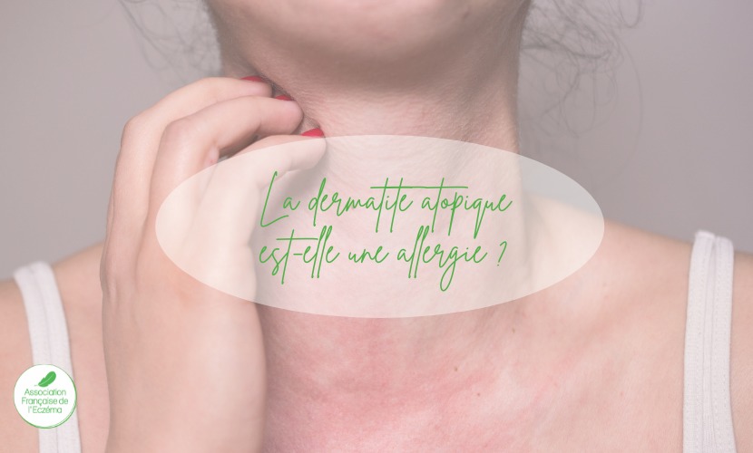 dermatite atopique est elle une allergie