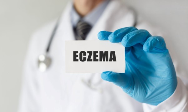 eczéma médecin consultation